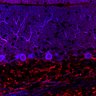 Thumbnail for dataset Fig1O_KO1_Lobule9_4