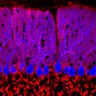 Thumbnail for dataset Fig1O_KO2_Lobule1_1