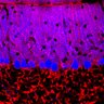 Thumbnail for dataset Fig1O_KO2_Lobule1_2