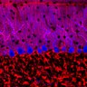 Thumbnail for dataset Fig1O_KO2_Lobule3_2