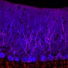 Thumbnail for dataset Fig1O_KO2_Lobule9_1