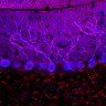 Thumbnail for dataset Fig1O_KO2_Lobule9_3