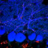 Thumbnail for dataset Fig2A_P18_Aldoc-Nega