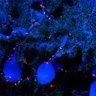 Thumbnail for dataset Fig2A_P18_Aldoc-Posi