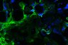 Thumbnail for dataset Fig5E_VB_baricitinib