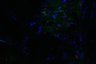 Thumbnail for dataset Fig5E_VB_tofacitinib