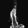 Thumbnail for dataset Fig3F_whorled arrange_3