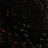 Thumbnail for dataset Fig1B_IL31RA_ctrl_1