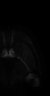 Thumbnail for dataset Fig3_brain_RightAnterior_2