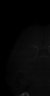 Thumbnail for dataset Fig3_brain_LeftAnterior_2