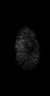 Thumbnail for dataset Fig4_xenograft_minus500_2