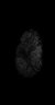Thumbnail for dataset Fig4_xenograft_minus1000_1