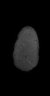 Thumbnail for dataset Fig4_xenograft_plus1000_1