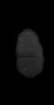 Thumbnail for dataset Fig4_xenograft_plus1000_2