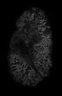 Thumbnail for dataset Fig4_xenograft_3Drender
