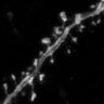 Thumbnail for dataset Fig4B_2PE-gSTED
