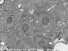 Thumbnail for dataset FE-SEM_WT_1_5_x6000