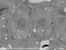 Thumbnail for dataset FE-SEM_WT_2_6_x8000
