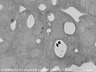 Thumbnail for dataset FE-SEM_an3_2_4_x6000