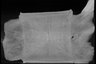 Thumbnail for dataset Paralichthys_olivaceus_SL218mm