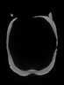 Thumbnail for dataset Zeus_faber_SL359mm