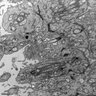 Thumbnail for dataset Fig4F_photoreceptor_high1