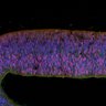 Thumbnail for dataset DD17_Rod_CRX_EtOH