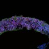 Thumbnail for dataset DD17_Rod_CRX_RA