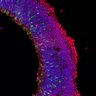 Thumbnail for dataset DD20_Sop_RXRg_RA