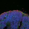 Thumbnail for dataset DD20_Sop_RXRg_T3