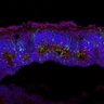 Thumbnail for dataset DD25_Sop_Trb2_R