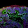 Thumbnail for dataset DD30_Rod_CRX_EtOH