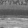 Thumbnail for Figure3A_EM_KO_Dorsal