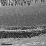 Thumbnail for dataset Figure3A_EM_WT_Dorsal