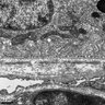 Thumbnail for dataset Figure3B_EM_KO_Ventral_RPE_BrM
