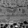 Thumbnail for Figure3B_EM_WT_Dorsal_RPE_BrM