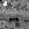 Thumbnail for dataset Figure3B_EM_WT_Ventral_RPE_BrM
