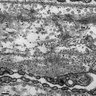 Thumbnail for dataset Figure3C_EM_KO_Ventral_choriocapillaris