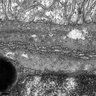 Thumbnail for dataset Figure3C_EM_WT_Ventral_choriocapillaris