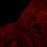 Thumbnail for Figure5_E12.5_VEGFR3
