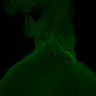 Thumbnail for Figure5_E15.0_Prox1