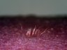 Thumbnail for dataset fig4D_bioengineeredhair_day57