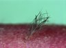 Thumbnail for dataset fig4D_bioengineeredhair_day69