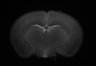 402-Tasaka-parentOFCactivity/Fig2_Rbp4_Ai162_F1_200804_AP2 thumbnail