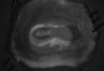 402-Tasaka-parentOFCactivity/Fig2_Rbp4_Ai162_F3_200902_LM thumbnail