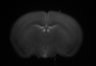 402-Tasaka-parentOFCactivity/Fig2_Rbp4_Ai162_F7_201102_LM thumbnail