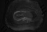 402-Tasaka-parentOFCactivity/Fig2_Rbp4_Ai162_F8_211007_AP2 thumbnail