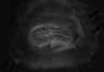 402-Tasaka-parentOFCactivity/Fig2_Rbp4_Ai162_Gi_SMTb_F4_211112_LM thumbnail