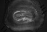 402-Tasaka-parentOFCactivity/Fig2_Rbp4_Ai162_Gi_SMTb_F6_211118_LM thumbnail