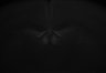 487-Tasaka-SMTmodulation/Fig4_Tnnt1_Ai162_MD_F9_220608_AP1 thumbnail